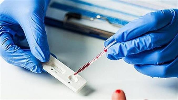 Υποχρεωτικά self tests για εργαζόμενους – εργοδότες βοηθούντες συγγενείς πρώτου βαθμού