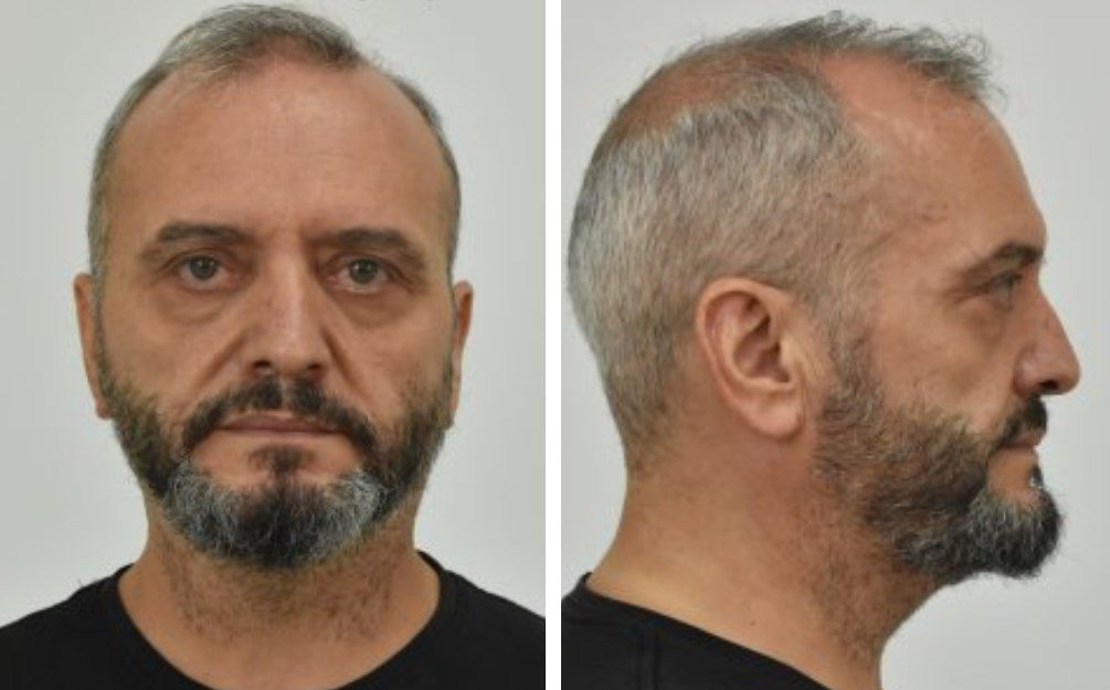 Βιασμός στον Κολωνό – Γιος 53χρονου: η ανάρτηση για τον πατέρα  “κτήνος” και την απόλυση του από εφημερίδα που εργαζόταν