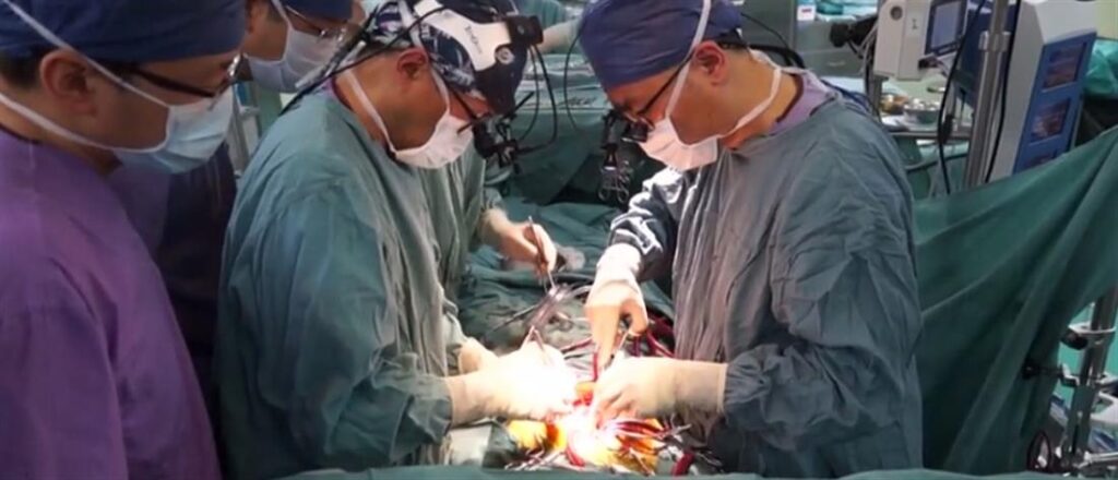 Νεφρό από χοίρο λειτουργεί σε ανθρώπινο σώμα 32 ημέρες μετά την επέμβαση