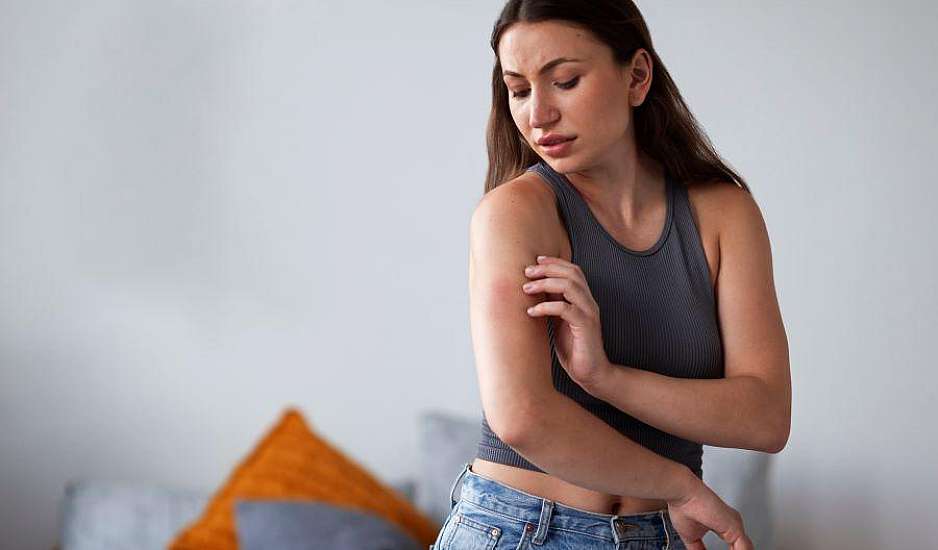 Εφτά λόγοι που τα κουνούπια τσιμπάνε πάντα και μόνο εσένα