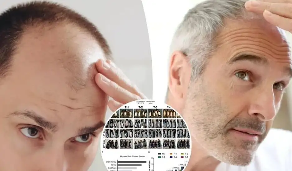 Έγινε κατά λάθος σημαντική ανακάλυψη για τη φαλάκρα; – Η απλή ουσία που διεγείρει την αναγέννηση των μαλλιών