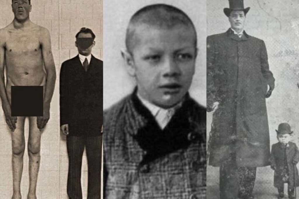 Ο άνθρωπος που γεννήθηκε νάνος και κατέληξε… γίγαντας