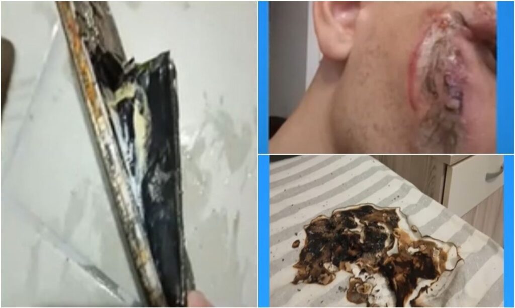 Λαχτάρα μέσα στη νύχτα – Έσκασε το κινητό του τηλέφωνο την ώρα που κοιμόταν