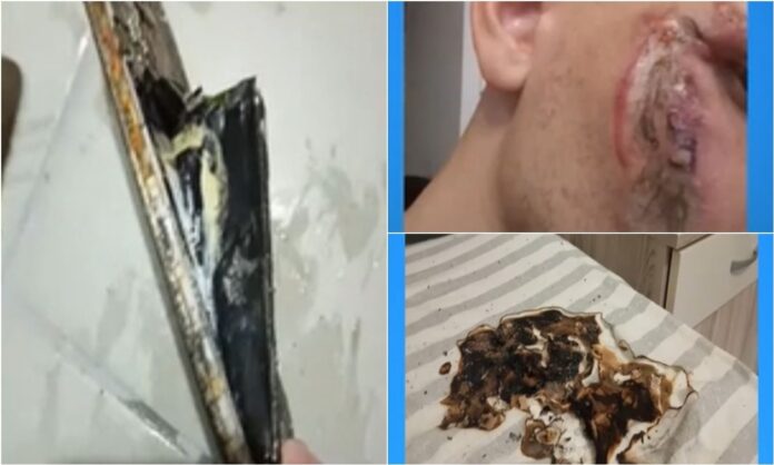 3453822f-kinhto-eskase