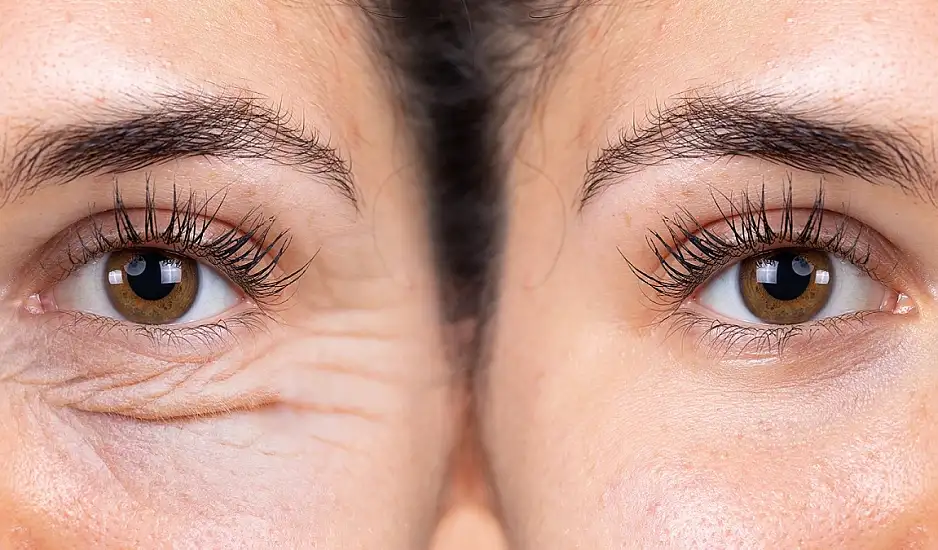 Σβήνουμε ρυτίδες με δύο υλικά. Πολύ απλό