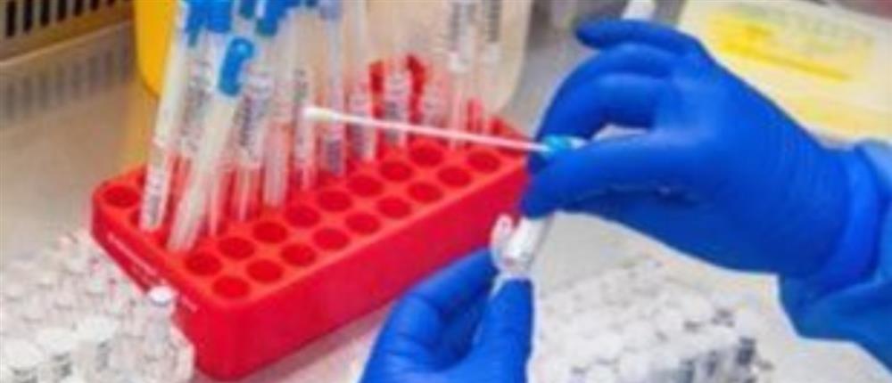 Κίνα: Ανακαλύφθηκε νέος κορονοϊός;