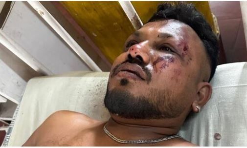 Air India: Ποιος είναι ο επιβάτης της θέσης 11Α που διεσώθη από την αεροπορική τραγωδία – Τι δήλωσε