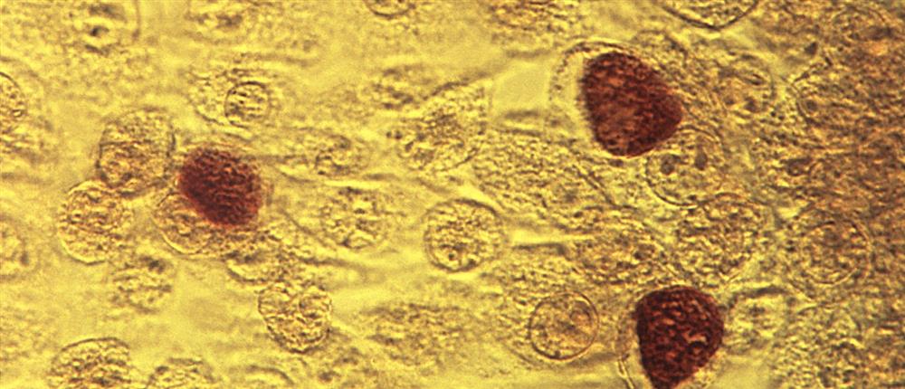 O ΕΟΔΥ κρούει τον κώδωνα του κινδύνου για αύξηση στα ΣΜΝ